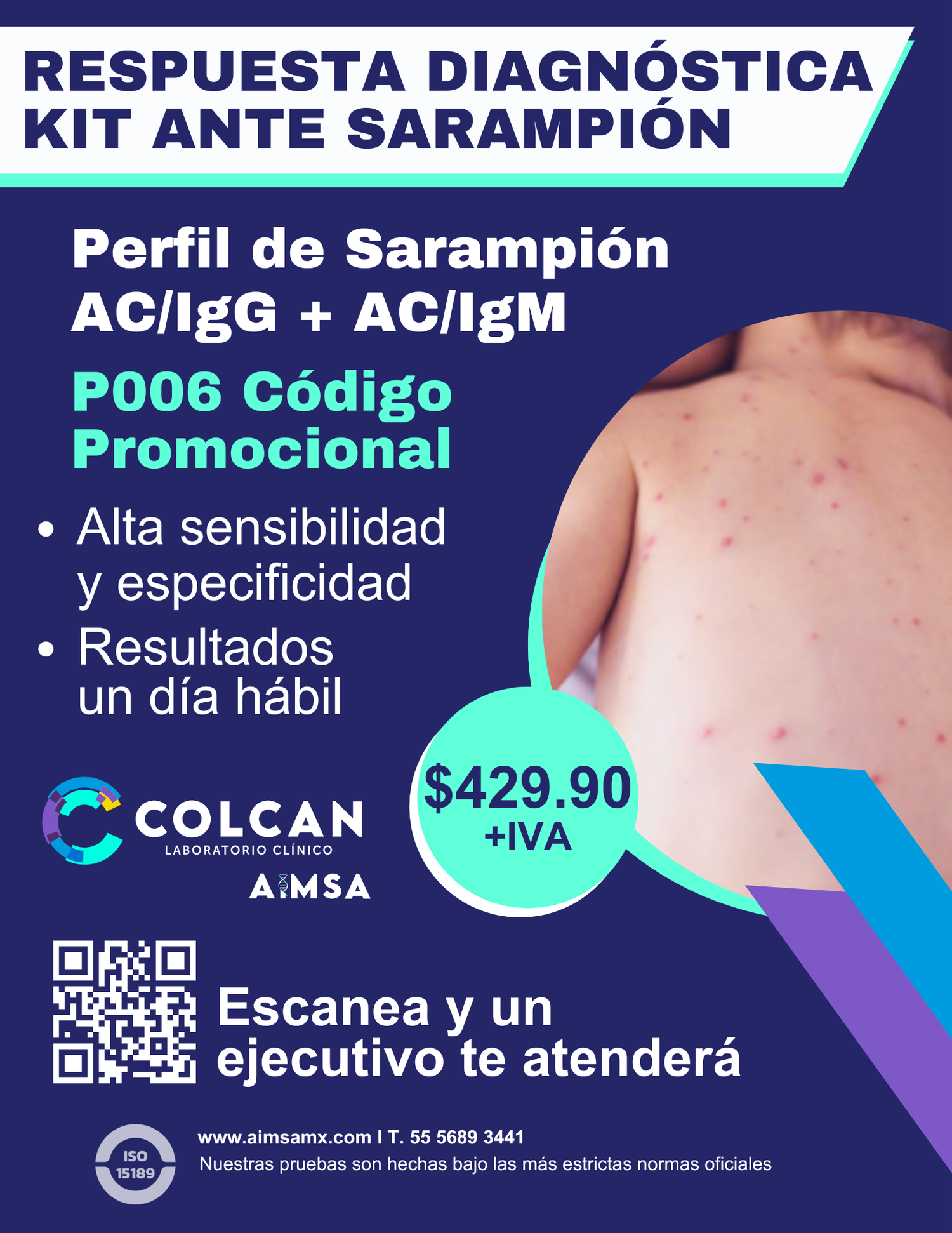 Perfil de Sarampión  AC/IgG + AC/IgM