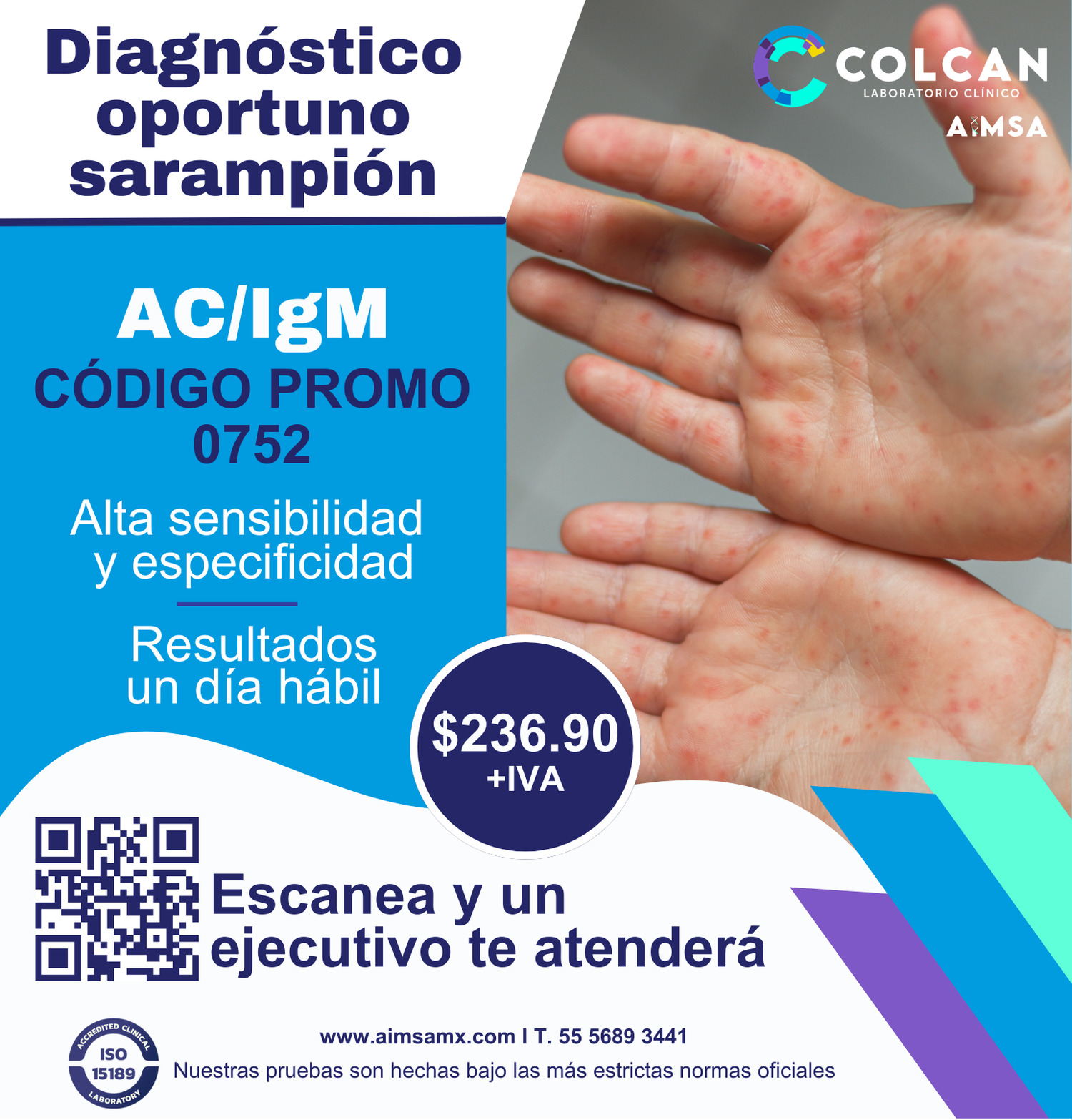 Análisis Clínico de Sarampión ACC IgM a precio presencial